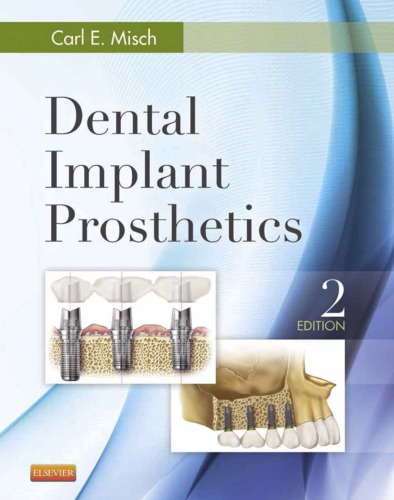 Dental implant prosthetics