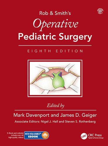Rob & Smith's Operative Pediatric Surgery