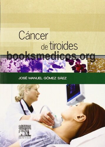 Cancer De Tiroides
