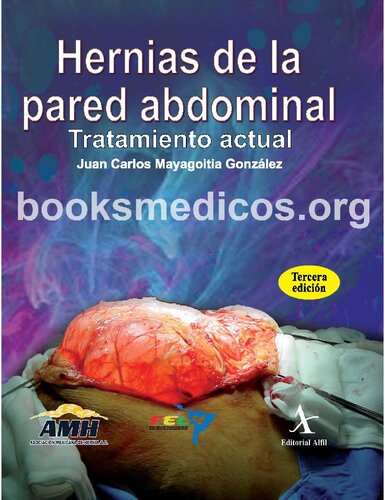 Hernias De La Pared Abdominal