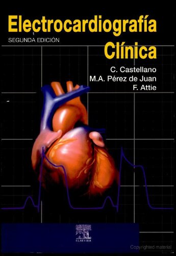 Electrocardiografía clínica