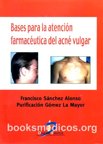 Bases Para La Atencion Farmaceutica Del Acne Vulgar
