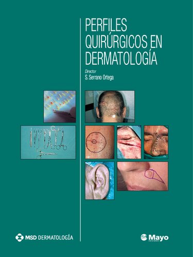 Perfiles Quirurgicos En Dermatologia