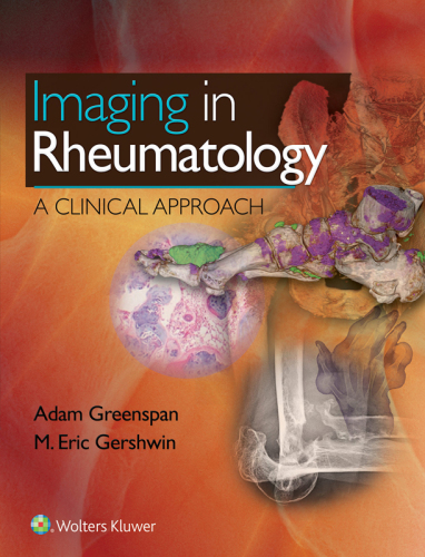 Imaging in Rheumatology A Clinical Approach