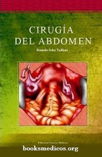 Cirugia Del Abdomen
