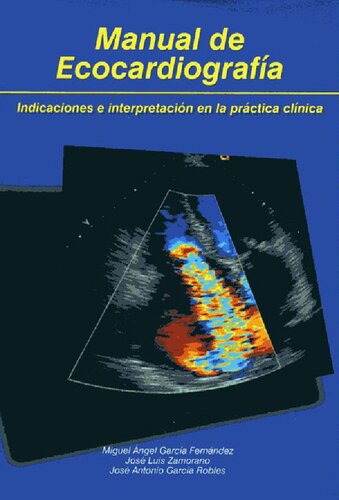 Manual De Ecocardiografia