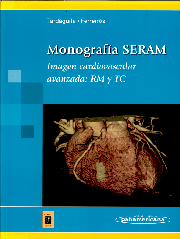 Imagen Cardiovascular Avanzada: Rm Y Tc