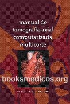 Manual De Tomografia Axial Computarizada Multicorte (3ed)