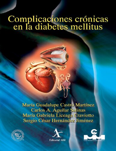 Complicaciones Cronicas En La Diabetes Mellitus