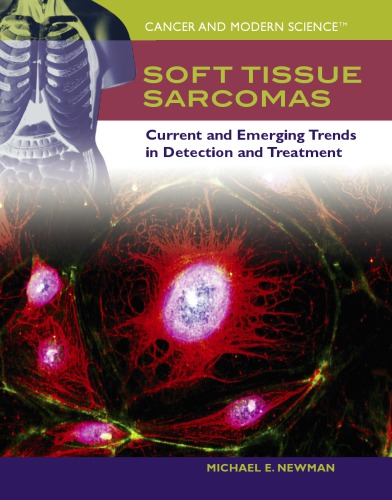 Soft Tissue Sarcomas: Current and Emerging Trends in Detection and Treatment