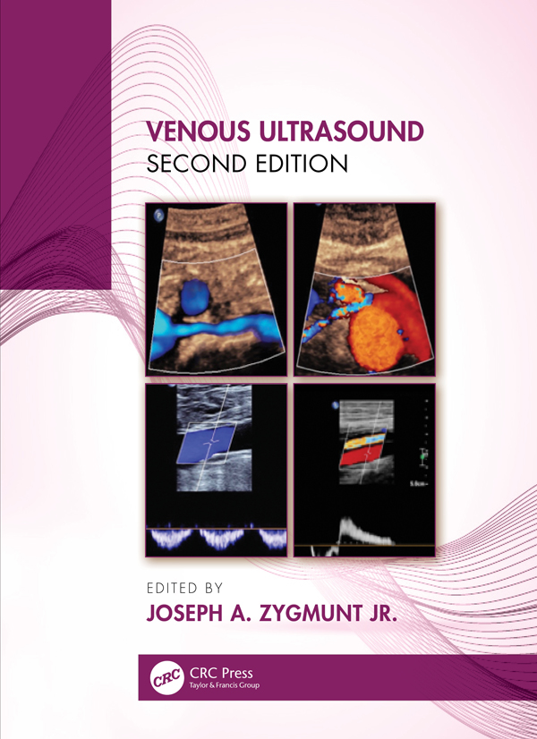 Venous ultrasound
