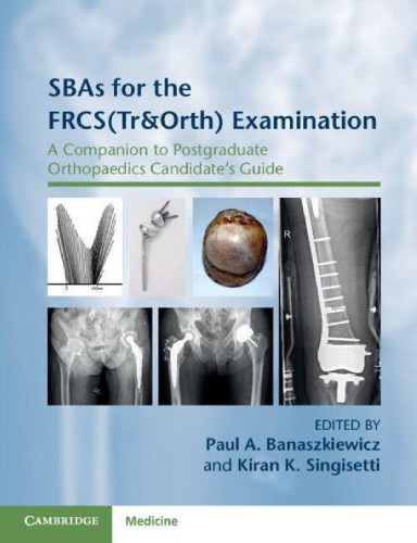 SBAs for the FRCS(Tr&Orth) Examination: A Companion to Postgraduate Orthopaedics Candidate’s Guide