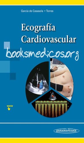 Ecografia Cardiovascular