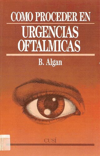 Como Proceder En Urgencias Oftalmologicas