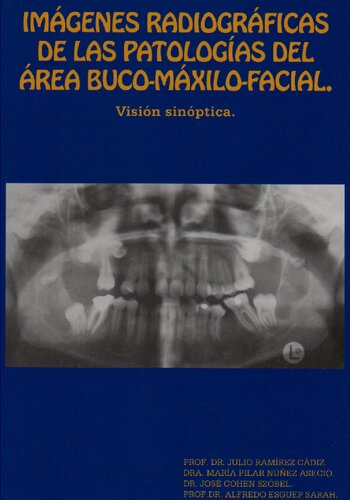 Imagenes Radiograficas De Las Patologias Del Area Buco
