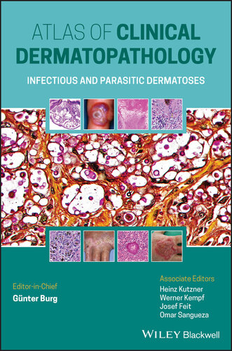 Atlas of Clinical Dermatopathology: Infectious and Parasitic Dermatoses