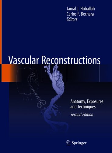 Vascular Reconstructions: Anatomy, Exposures and Techniques