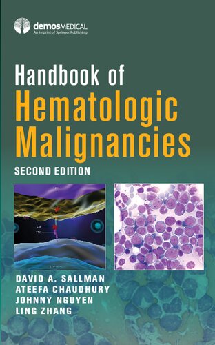 Handbook of hematologic malignancies