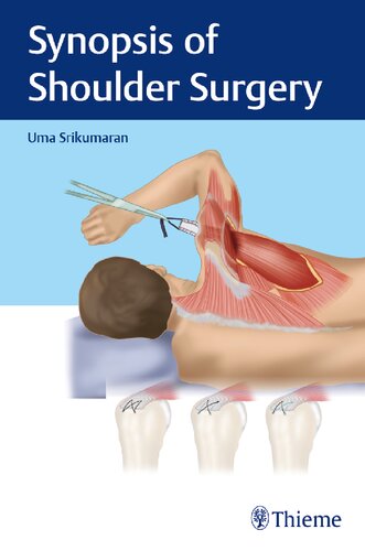 Synopsis of Shoulder Surgery