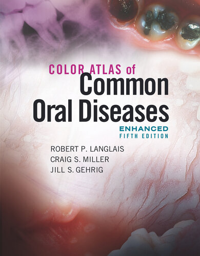 Color Atlas of Common Oral Diseases, Enhanced 5th Edition