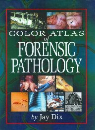 Color.Atlas.of.Forensic.Pathology.eBook-EEn