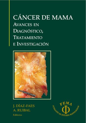 Cáncer de mama : avances en diagnóstico, tratamiento e investigación