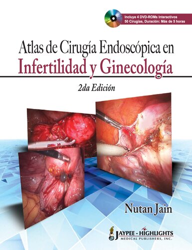Atlas de Cirugía Endoscópica para Infertilidad y Ginecología