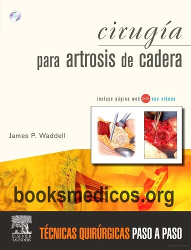 Cirugía para artrosis de cadera