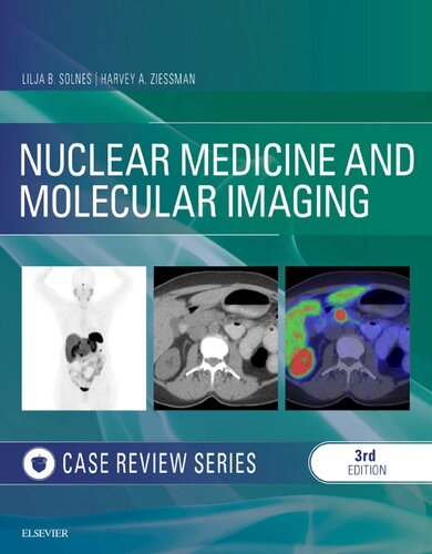 Nuclear Medicine and Molecular Imaging: Case Review Series