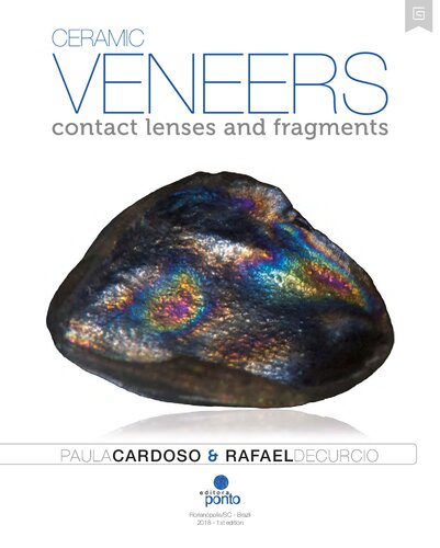 Ceramic veneers: contact lenses and fragments