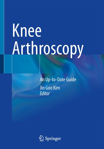 Knee Arthroscopy: An Up-to-Date Guide