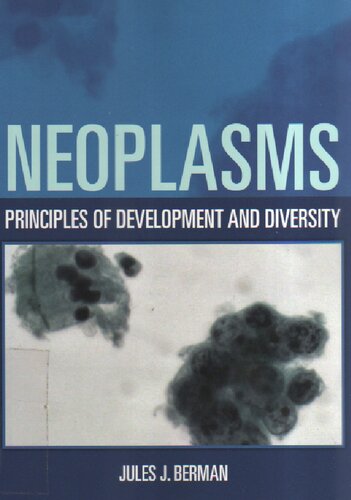 Neoplasms. Principles of development and diversity