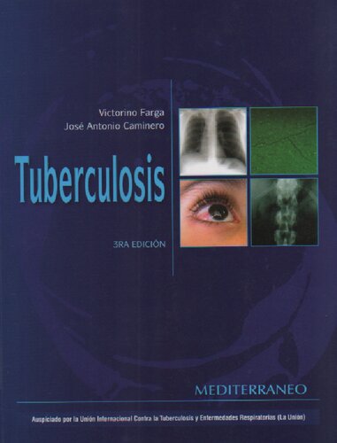 Tuberculosis