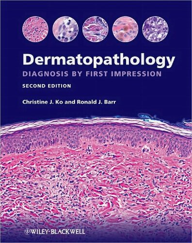 Dermatopathology. Diagnosis by First Impression