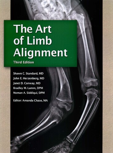 The Art of Limb Alignment