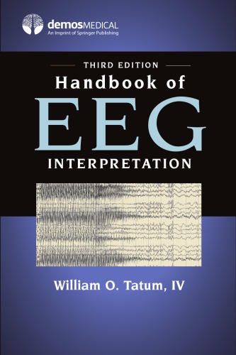 Handbook of EEG Interpretation