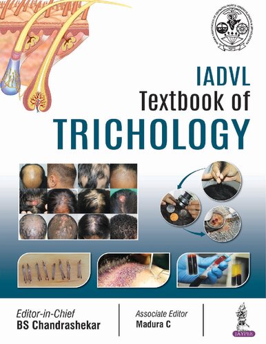 IADVL Textbook of Trichology