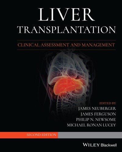 Liver Transplantation: Clinical Assessment and Management