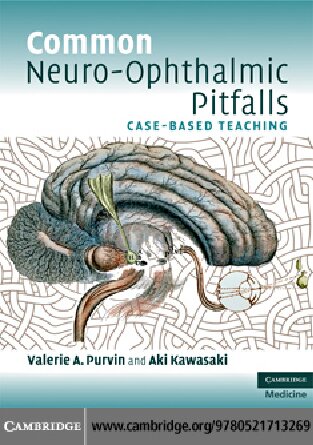 Common Neuro-Ophthalmic Pitfalls (Case-Based Teaching)