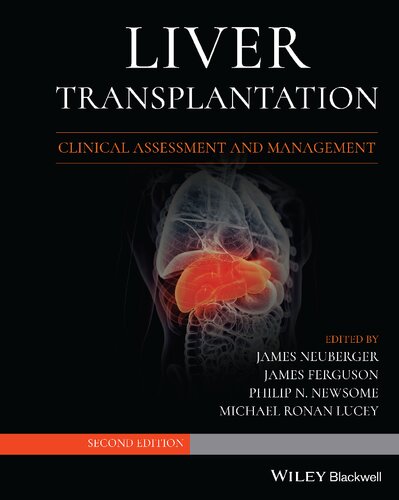 Liver Transplantation: Clinical Assessment and Management