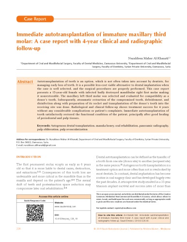 Immediate autotransplantation of immature maxillary third molar: A case report with 4‐year clinical and radiographic follow‐up