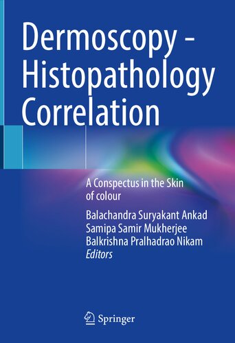 Dermoscopy - Histopathology Correlation. A Conspectus in the Skin of colour