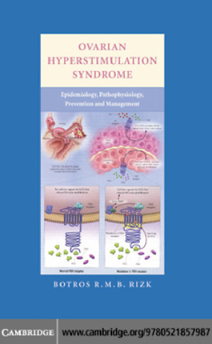 Ovarian Hyperstimulation Syndrome: Epidemiology, Pathophysiology, Prevention and Management