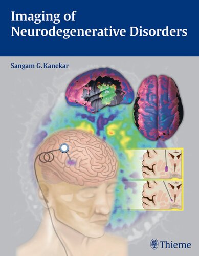 Imaging of Neurodegenerative Disorders