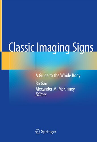 Classic Imaging Signs. A Guide to the Whole Body