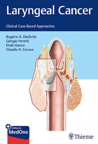 Laryngeal Cancer. Clinical Case-Based Approaches