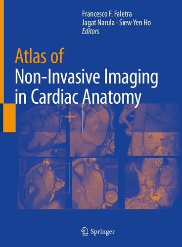Atlas of Non-Invasive Imaging in Cardiac Anatomy