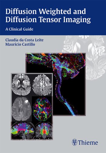 Diffusion Weighted and Diffusion Tensor Imaging. A Clinical Guide