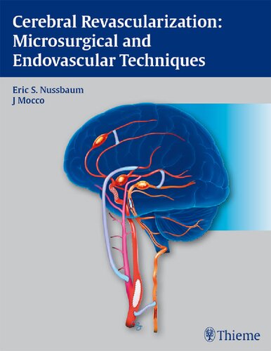 Cerebral Revascularization Microsurgical and Endovascular Techniques