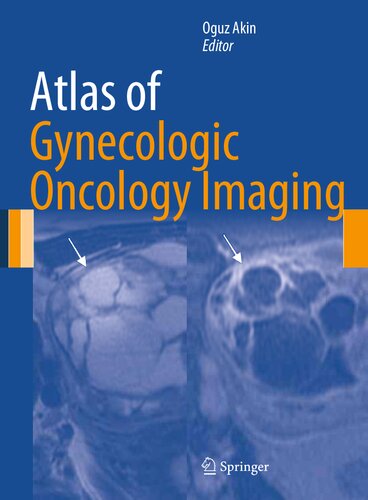 Atlas of Gynecologic Oncology Imaging